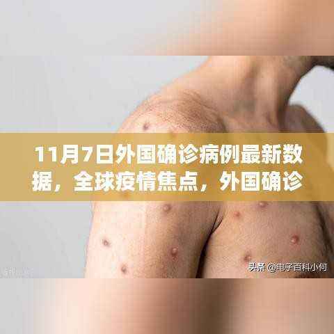 全球疫情焦点,外国确诊病例最新数据分析(11月7日更新)