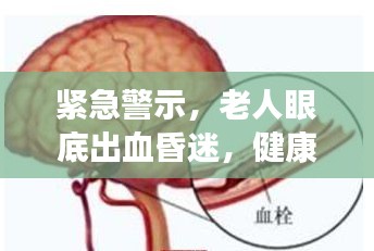 紧急警示,老人眼底出血昏迷,健康危机需警惕