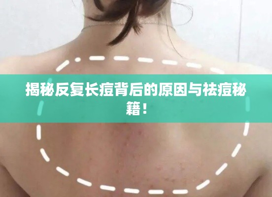 揭秘反复长痘背后的原因与祛痘秘籍！